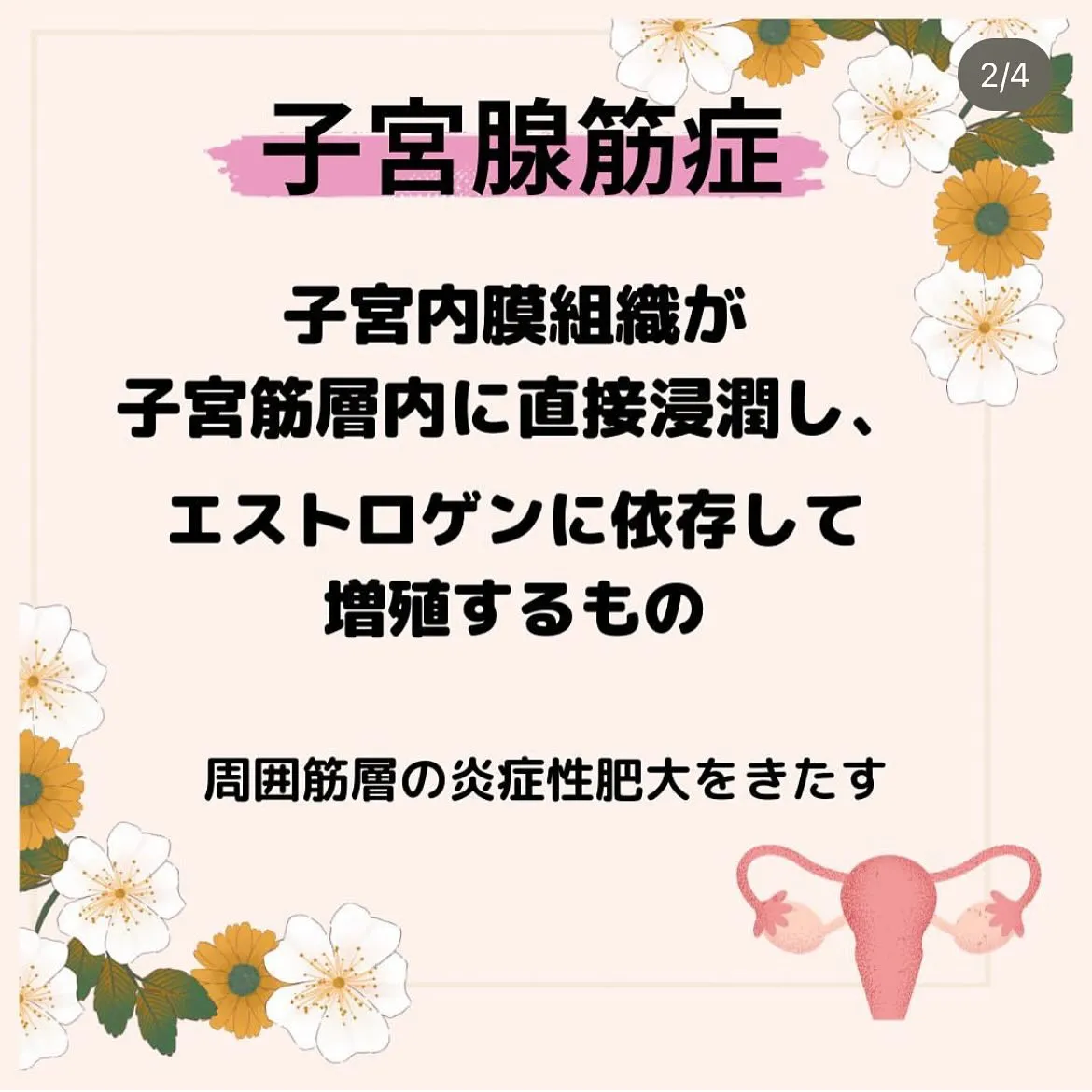 【子宮腺筋症って？ としみ】